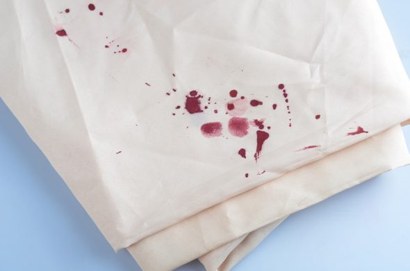 Blood stains on clothes